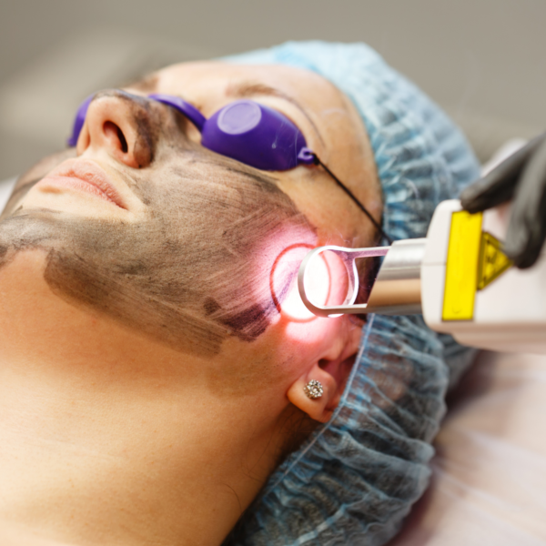 Skin Resurfacing