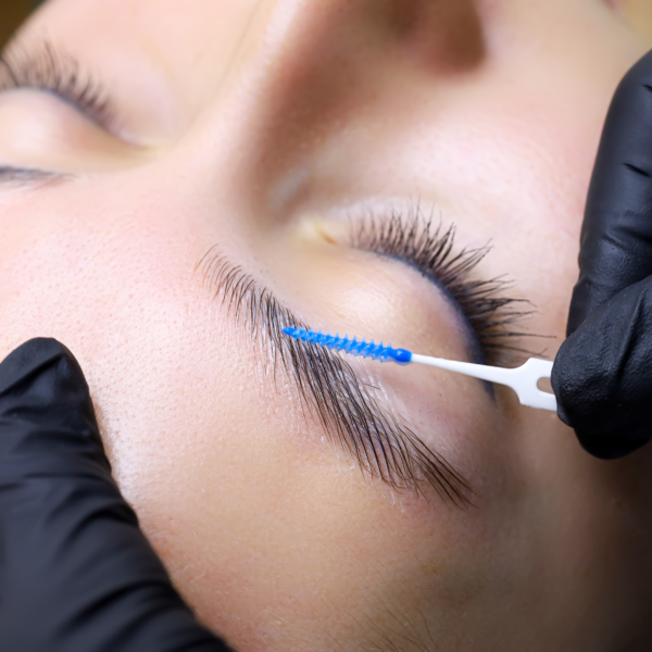 Brow Lift